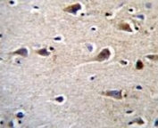 CRFR2D antibody immunohistochemistry analysis in formalin fixed and paraffin embedded human brain tissue.