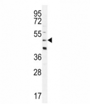 CRFR2D antibody western blot analysis in HeLa lysate