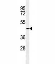 TMPRSS11E2 antibody western blot analysis in NCI-H292 lysate.