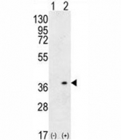 Western blot analysis of HLA-DQA1 antibody and 293 cell lysate (2 ug/lane) either nontransfected (Lane 1) or transiently transfected (2) with the HLA-DQA1 gene.