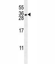 HLA-DQA1 antibody western blot analysis in NCI-H460 lysate.