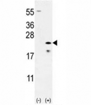 Western blot analysis of Bax antibody and 293 cell lysate (2 ug/lane) either nontransfected (Lane 1) or transiently transfected (2) with the Bax gene.