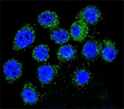 Confocal immunofluorescent analysis of IGF1 antibody with A549 cells followed by Alexa Fluor 488-conjugated goat anti-rabbit lgG (green). DAPI was used as a nuclear counterstain (blue).