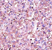 IGF1 antibody immunohistochemistry analysis in formalin fixed and paraffin embedded human liver tissue.
