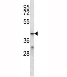 MFSD2B antibody western blot analysis in ZR-75-1 lysate.