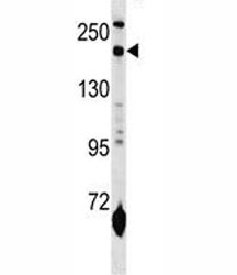 MRC1L1 antibody western blot analysis in mouse lung tissue lysate