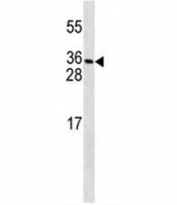 PDGFC antibody western blot analysis in MDA-MB231 lysate.