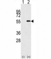 Western blot analysis of NUP50 antibody and 293 cell lysate (2 ug/lane) either nontransfected (Lane 1) or transiently transfected with the NUP50 gene (2).