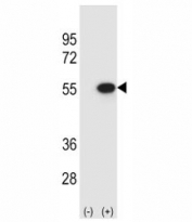 Western blot analysis of Reptin antibody and 293 cell lysate (2 ug/lane) either nontransfected (Lane 1) or transiently transfected (2) with the RUVBL2 gene.