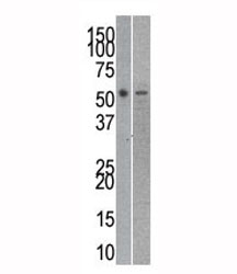 Reptin antibody used in western blot to detect RUVBL2 in mouse kidney (left) and SK-Br-3 (right) lysate~