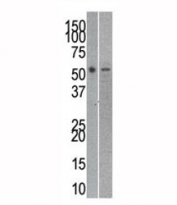 Reptin antibody used in western blot to detect RUVBL2 in mouse kidney (left) and human SK-BR-3 (right) lysate. Expected molecular weight: 48-51 kDa.