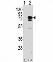 Western blot analysis of EIF4B antibody and 293 cell lysate (2 ug/lane) either nontransfected (Lane 1) or transiently transfected with the EIF4B gene (2).