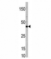 Western blot analysis of TCF7 antibody and mouse heart tissue lysate.