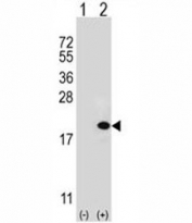 Western blot analysis of UBE2V1 antibody and 293 cell lysate (2 ug/lane) either nontransfected (Lane 1) or transiently transfected (2) with the UBE2V1 gene.