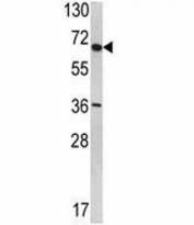 Western blot analysis of SYVN1 antibody in T47D lysate. Predicted molecular weight: ~68kDa.