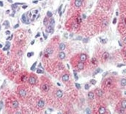 IHC analysis of FFPE human liver tissue stained with SYVN1 antibody