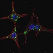 Fluorescent confocal image of HeLa cells stained with SYVN1 antibody. Primary Ab (1:200, 2 h at room temperature); Alexa Fluor 488 conjugated donkey anti-rabbit Ab (green) was used as secondary (1:1000, 1h). Nuclei were counterstained with Hoechst 33342 (blue) (10 ug/ml, 5 min).