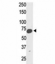 Western blot analysis of SYVN1 mouse kidney tissue lysate. Predicted molecular weight: ~68kDa.