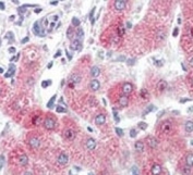 IHC analysis of FFPE human liver tissue stained with SYVN1 antibody