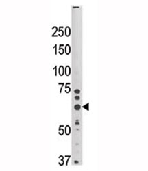 Western blot analysis of HRD1 antibody and mouse brain tissue lysate.