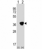 Western blot analysis of AKR1A1 antibody and 293 cell lysate (2 ug/lane) either nontransfected (Lane 1) or transiently transfected (2) with the AKR1A1 gene. Predicted molecular weight: ~37kDa.