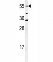 Western blot analysis of CYP26A1 antibody and mouse NIH3T3 cell lysate.