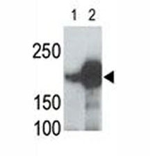 LRP5 antibody used in western blot to detect recombinant human LRP5 (Lane 1) and mouse LRP5 (2) proteins in transfected 293 cell lysate; Data is kindly provided by Drs. V. Harris and S. Aaronson from the Mount Sinai School of Medicine~