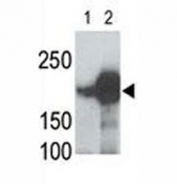 LRP5 antibody used in western blot to detect recombinant human LRP5 (Lane 1) and mouse LRP5 (2) proteins in transfected 293 cell lysate; Data is kindly provided by Drs. V. Harris and S. Aaronson from the Mount Sinai School of Medicine