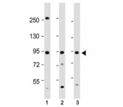 TAP1 antibody western blot analysis in human 1) HepG2, 2) Jurkat and 3) SW480 cell lysate. Expected/observed molecular weight ~87 kDa.