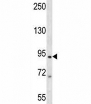 TAP1 antibody western blot analysis in Jurkat lysate. Expected/observed molecular weight ~87 kDa.