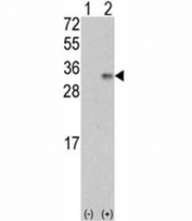 Western blot analysis of VEGFB antibody and 293 cell lysate (2 ug/lane) either nontransfected (Lane 1) or transiently transfected with the VEGF2/VEGFB gene (2). Expected molecular weight: 22-32 kDa depending on glycosylation level.