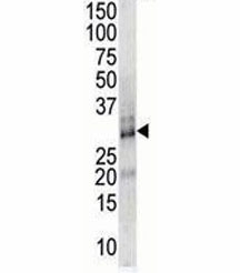 DSCR1 antibody used in western blot to detect DSCR1 in endothelial cell lysate~