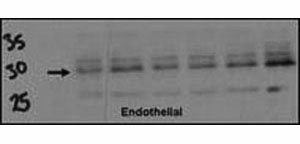 Western blot testing of DSCR1 antibody (1:500) and endothelial cell lysate. Data courtesy of Dr. Katherine Healey, NWCRF Institute, School of Biological Sc