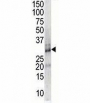 DSCR1 antibody used in western blot to detect DSCR1 in endothelial cell lysate