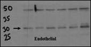Endothelial cell lysate transferred to membrane was incubated with DSCR1 antibody at a 1:500 dilution. Data courtesy of Dr. Katherine Healey, NWCRF Institute, School of Biological Sciences, University of Wales Bangor.~