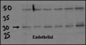 Endothelial cell lysate transferred to membrane was incubated with DSCR1 antibody at a 1:500 dilution. Data courtesy of Dr. Katherine Healey, NWCRF Institute, School of Biological Sciences, University of Wales Bangor.