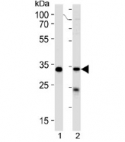 STUB1 antibody western blot analysis in 1) 293 cell line and 2) human placenta lysate. Predicted molecular weight ~35 kDa.