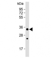 CHIP / STUB1 antibody western blot analysis in MCF7 lysate. Predicted molecular weight ~35 kDa.