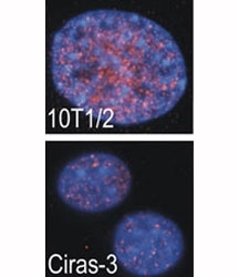 Indirect IF analysis showed that RSKB is localized in the nucleus of parental (10T1/2) and oncogene-transformed (Ciras-3) mouse fibroblasts; DAPI nuclear counterstain. Courtesy of B. Drobic and Dr. J. Davie, Univ. of Manitoba.~