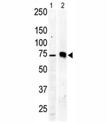 Western blot testing of PKC beta 2 antibody and Jurkat cell lysate (lane 1) and mouse brain tissue lysate (2).~