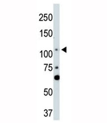 LATS2 antibody used in western blot to detect LATS2 in NIH3T3 cell lysate~
