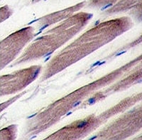IHC analysis of FFPE human skeletal muscle tissue stained with LATS2 antibody