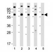 Western blot testing of Pyruvate Kinase antibody at 1:2000 dilution. Lane 1: MCF-7 lysate; 2: HeLa; 3: THP-1; 4: NIH3T3; 5: PC-12; Predicted molecular weight ~ 58 kDa.
