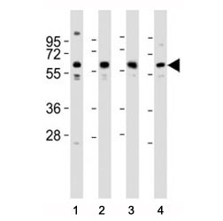 Western blot testing of Pyruvate Kinase antibody at 1:2000 dilution. Lane 1: MCF-7 lysate; 2: HeLa; 3: NIH3T3; 4: PC-12; Predicted molecular weight ~ 60 kDa.~