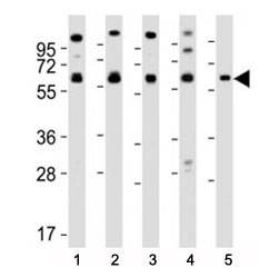 Western blot testing of Pyruvate Kinase antibody at 1:2000 dilution. Lane 1: