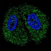 Fluorescent confocal image of MCF7 cells stained with PKM2 antibody. Alexa Fluor 488 conjugated donkey anti-rabbit secondary Ab (green) was used (1:1000, 1h). Nuclei were counterstained with Hoechst 33342 (blue) (10 ug/ml, 5 min). PKM2 is localized to the cytoplasm.