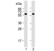 Western blot testing of human 1) HeLa and 2) MCF-7 cell lysate using PKM2 antibody. Predicted molecular weight ~58 KDa.