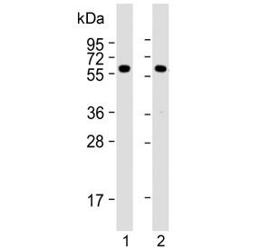 Western blot testing of human 1) HeLa and 2) MCF-7 cell lysate using PKM2 antibody. Predicted molecular weight ~58 KDa.