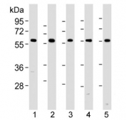 Western blot analysis of lysate from 1) human HeLa, 2) human A549, 3) mouse NIH3T3, 4) mouse C2C12, and 5) rat PC-12 lysate using PKM2 antibody at 1:1000. Predicted molecular weight ~58 KDa.