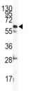 Western blot analysis of anti-ILK2/ILK1 antibody and mouse heart tissue lysate